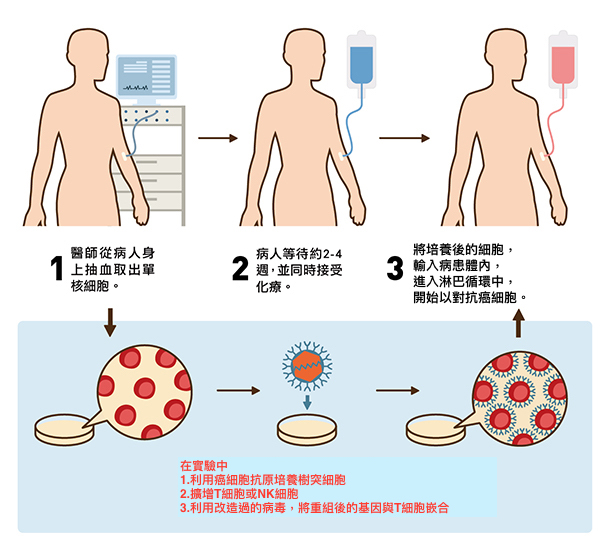 自體免疫細胞療法 也可戰勝癌症 台灣癌症基金會fcf